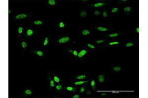 Immunofluorescence of purified MaxPab antibody to ING4 on HeLa cell.