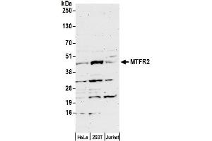 anti-Family with Sequence Similarity 54, Member A (FAM54A) (AA 335-385) antibody
