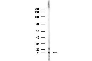 Western blot analysis of lysates from F10-LUC cells(starvation,24h treatment), using MRPS12 Antibody at 1/1000 dilution.