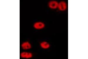 ABIN6275685 staining HepG2 by IF/ICC. (ZSCAN22 anticorps  (Internal Region))