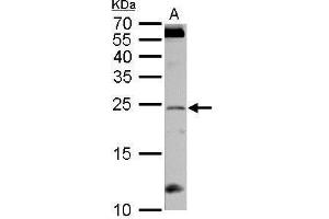 WB Image RGS4 antibody detects RGS4 protein by Western blot analysis. (RGS4 anticorps)