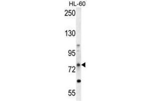 ABCD1 Antibody (Center) western blot analysis in HL-60 cell line lysates (35 µg/lane). (ABCD1 anticorps  (Middle Region))
