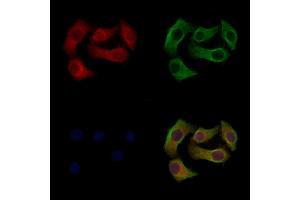 Phospho-SCD1 (Tyr55) Antibody staining Hela cells(heat shock treatment) by IF/ICC. (SCD anticorps  (pTyr55))
