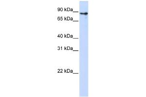 WB Suggested Anti-KLHL1 Antibody Titration:  0. (KLHL1 anticorps  (Middle Region))