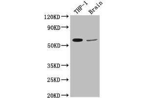 Western Blot Positive WB detected in: THP-1 whole cell lysate, Rat brain tissue All lanes: COL9A2 antibody at 1:2000 Secondary Goat polyclonal to rabbit IgG at 1/50000 dilution Predicted band size: 66 kDa Observed band size: 66 kDa