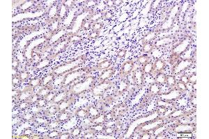 Formalin-fixed and paraffin embedded rat renal tissue labeled with Anti-TGF-beta-1 Polyclonal Antibody, Unconjugated (ABIN724685) 1:200 followed by conjugation to the secondary antibody and DAB staining