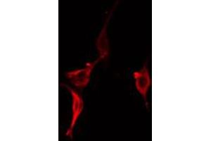 ABIN6274925 staining RAW264. (BAIAP2L2 anticorps  (Internal Region))
