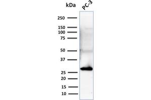 Western Blot Analysis of Human PC-3 cell lysate using Stratifin Mouse Monoclonal Antibody (CPTC-SFN-2). (14-3-3 sigma/SFN anticorps)