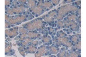 Detection of 15-LO-2 in Rat Pancreas Tissue using Polyclonal Antibody to 15-Lipoxygenase-2 (15-LO-2) (ALOX15B anticorps  (AA 349-633))