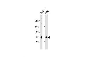 Western Blot at 1:1000 dilution Lane 1: Jurkat whole cell lysate Lane 2: K562 whole cell lysate Lysates/proteins at 20 ug per lane.