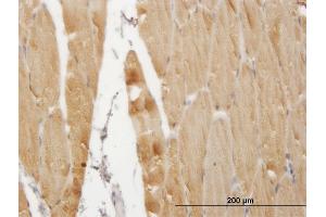 Immunoperoxidase of monoclonal antibody to ATP2A1 on formalin-fixed paraffin-embedded human skeletal muscle.