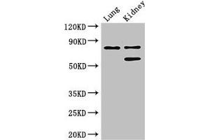 LEPREL1 anticorps  (AA 301-528)