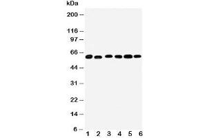 Western blot testing of Monoamine Oxidase B antibody and Lane 1:  mouse liver;  2: (m) lung;  3: rat kidney;  4: (r) brain;  5: (r) liver;  6: (r) lung tissue lysate (Monoamine Oxidase B anticorps  (N-Term))
