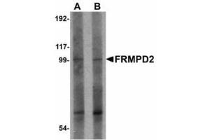 Image no. 1 for anti-FERM and PDZ Domain Containing 2 (FRMPD2) (N-Term) antibody (ABIN478186)