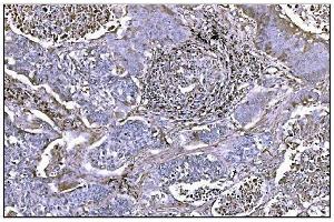 IHC analysis of NDEL1 using anti-NDEL1 antibody (ABIN7602511). (NDEL1 anticorps  (AA 80-320))