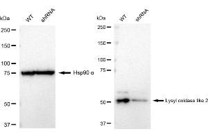 Western blotting analysis using Lysyl oxidase like 2 antibody (ABIN7799312). (Recombinant LOXL2 anticorps)