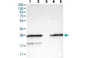 Western Blot analysis of (1) Human RT-4 cell, (2) Human U-251MG cell, (3) Human plasma (IgG/HSA depleted), (4) Human liver tissue, (5) Human tonsil tissue.