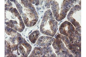 Image no. 4 for anti-Armadillo Repeat Containing 1 (ARMC1) antibody (ABIN1496727) (ARMC1 anticorps)