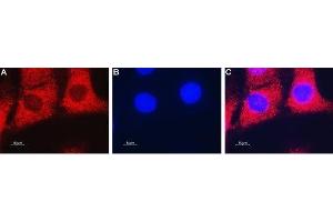 Expression of ENT2 in mouse C2C12 myoblast cells - Immunocytochemical staining of fixed and permeabilized mouse C2C12 myoblast cells.