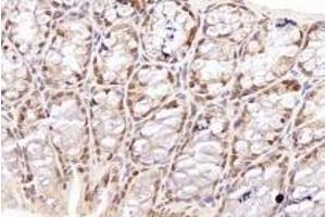 Immunohistochemistry analysis of paraffin-embedded mouse colon using,TORC1 (ABIN7073590) at dilution of 1: 800 (CRTC1 anticorps)
