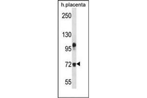 Western blot analysis of Fibulin-1 Antibody (C-term) in human placenta tissue lysates (35ug/lane). (Fibulin 1 anticorps  (C-Term))