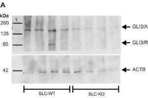 Western Blot of GLI3 in the SLC mice.