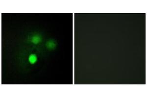 Immunofluorescence analysis of HUVEC cells, using KNTC2 antibody. (NDC80 anticorps  (Internal Region))
