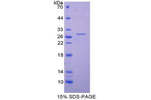 SDS-PAGE of Protein Standard from the Kit (Highly purified E. (TNNI3 Kit CLIA)
