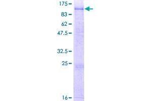 Image no. 1 for Carboxypeptidase X (M14 Family), Member 1 (CPXM1) (AA 1-734) protein (GST tag) (ABIN1350258)