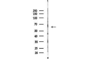 anti-Cytochrome P450 4A11/22 (Internal Region) antibody