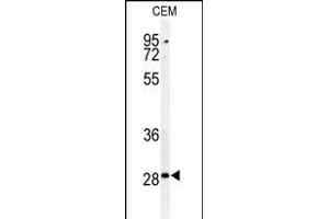 Western blot analysis of CASP3 (Asp175) Antibody (ABIN651176 and ABIN2840112) in CEM cell line lysates (35 μg/lane).