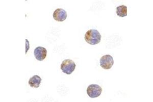 Immunocytochemistry of TIRP in Raji cells with this product at 10 μg/ml. (TICAM2 anticorps  (C-Term))