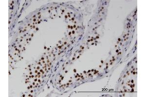 Immunoperoxidase of monoclonal antibody to RNF25 on formalin-fixed paraffin-embedded human testis.