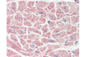 Anti-TADA3 / ADA3 antibody IHC staining of human heart. (TADA3L anticorps  (C-Term))