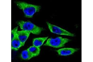 Confocal immunofluorescent analysis of LDHA antibody with A375 cells followed by Alexa Fluor 488-conjugated goat anti-rabbit lgG (green). (Lactate Dehydrogenase A anticorps  (AA 204-232))
