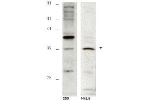 Western blot using  affinity purified anti-Hus1B antibody shows detection of a 36kDa band corresponding to Hus1B in a HeLa cell lysate (arrowhead). (HUS1B anticorps  (AA 104-117))