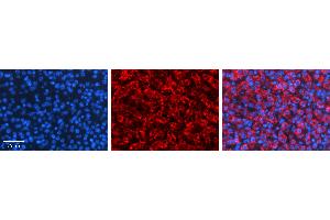 Rabbit Anti-TAPBP Antibody   Formalin Fixed Paraffin Embedded Tissue: Human Liver Tissue Observed Staining: Cytoplasm in hepatocytes Primary Antibody Concentration: 1:100 Other Working Concentrations: N/A Secondary Antibody: Donkey anti-Rabbit-Cy3 Secondary Antibody Concentration: 1:200 Magnification: 20X Exposure Time: 0.