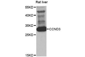 Western blot analysis of extracts of rat liver, using CCND3 antibody (ABIN5970442) at 1/1000 dilution. (Cyclin D3 anticorps)