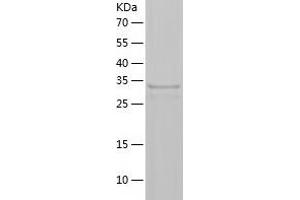 Western Blotting (WB) image for Tryptophan Hydroxylase 2 (TPH2) (AA 151-466) protein (His-IF2DI Tag) (ABIN7125512)