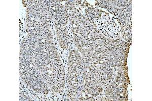 IHC analysis of 53BP1/TP53BP1 using anti-53BP1/TP53BP1 antibody (ABIN7599869). (TP53BP1 anticorps  (AA 1239-1972))