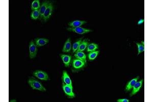 Immunofluorescent analysis of HepG2 cells using ABIN7160916 at dilution of 1:100 and Alexa Fluor 488-congugated AffiniPure Goat Anti-Rabbit IgG(H+L)