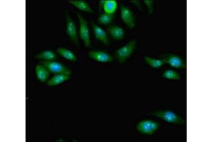 Immunofluorescent analysis of A549 cells using ABIN7163798 at dilution of 1:100 and Alexa Fluor 488-congugated AffiniPure Goat Anti-Rabbit IgG(H+L) (PCGF2 anticorps  (AA 103-316))