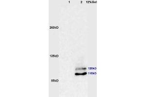 Lane 1: human colon carcinoma lysates Lane 2: mouse brain lysates probed with Anti phospho-PI3 Kinase p110 beta(Ser1070) Polyclonal Antibody, Unconjugated (ABIN872304) at 1:200 in 4 °C.