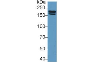 Detection of PZP in Rat Serum using Polyclonal Antibody to Pregnancy Zone Protein (PZP)