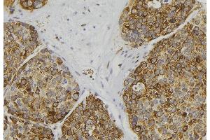 ABIN6279063 at 1/100 staining Human pancreas tissue by IHC-P. (AWAT2 anticorps  (Internal Region))