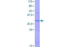 Adiponectin (ADIPOQ) (AA 111-210) protein (GST tag)