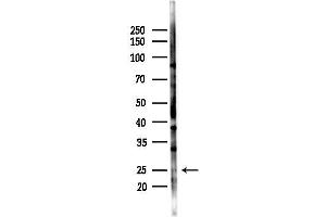 Western blot analysis of lysates from HepG2 cells(heat-shock,45 min treatment), using LSM1 Antibody at 1/1000 dilution.