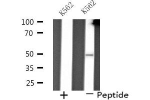 Western blot analysis of extracts from K562 cells using PP4R2 antibody. (PPP4R2 anticorps  (Internal Region))