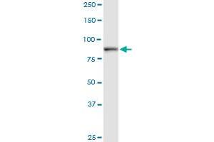DCAMKL1 monoclonal antibody (M01), clone 7D10. (DCLK1 anticorps  (AA 640-729))
