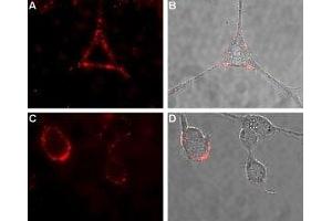 Expression of CALCR in rat PC12 cells - Cell surface detection of CALCR in intact living rat pheochromocytoma (PC12) cells.